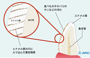 ホワイトニングとは