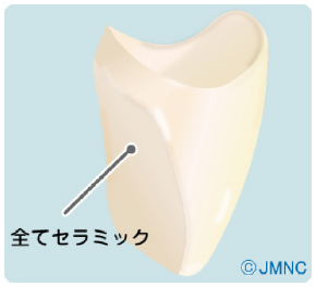 セラミッククラウン