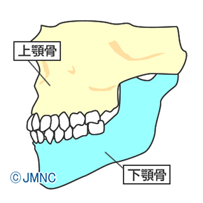 顎関節症とは